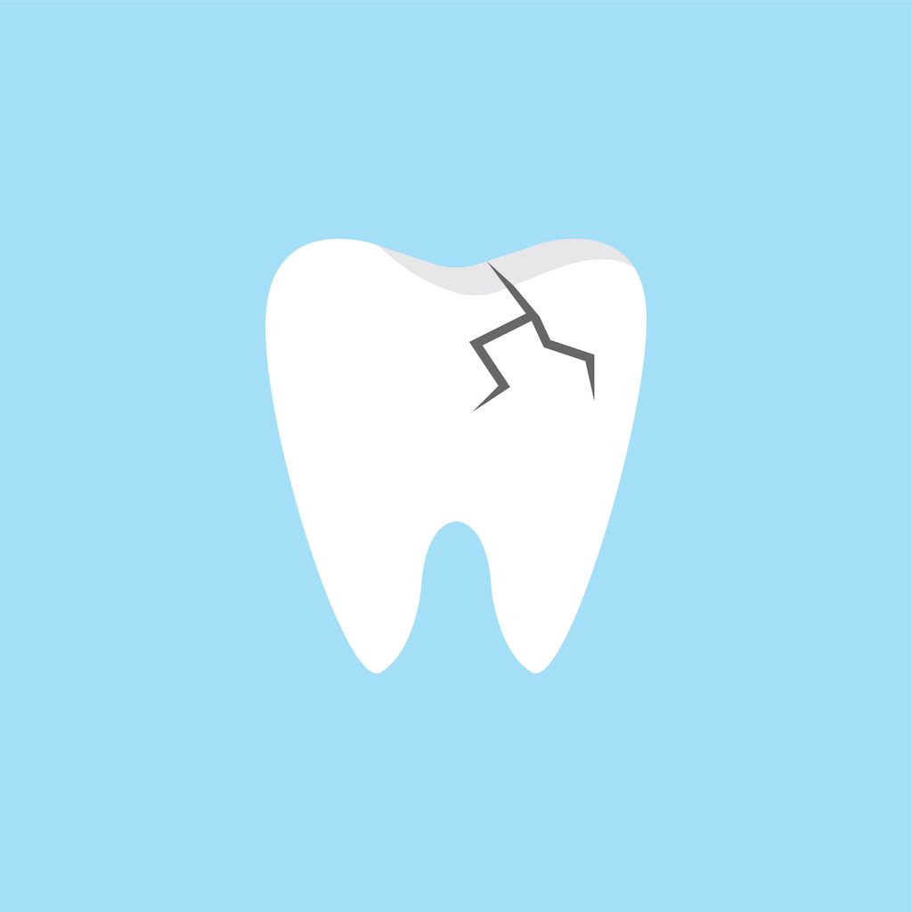 Treatment Options for Tooth Fractures